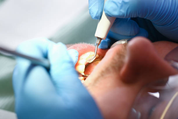 Best Same-Day Emergency Dental Services in South Hutchinson, KS