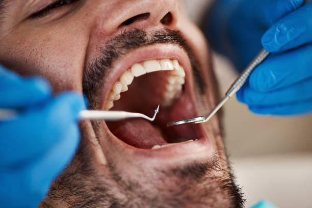 Best Emergency Tooth Extraction in South Hutchinson, KS