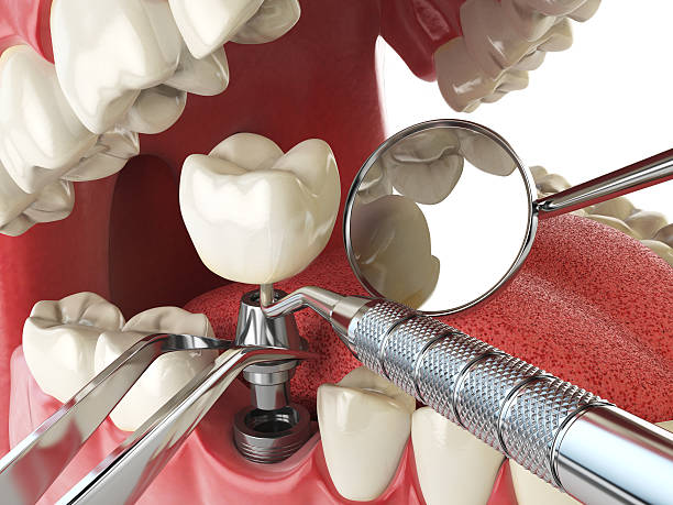 Best Urgent Care for Lost Fillings or Crowns in South Hutchinson, KS
